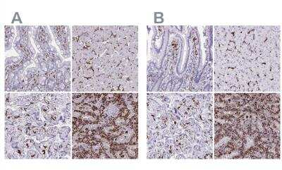 Immunohistochemistry-Paraffin: CD163 Antibody [NBP2-48846]