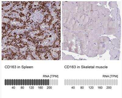 Immunohistochemistry-Paraffin: CD163 Antibody [NBP2-48846]