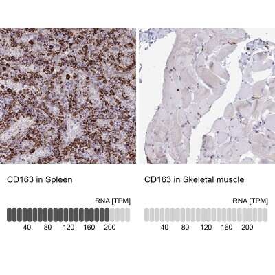 Immunohistochemistry-Paraffin: CD163 Antibody [NBP2-49028]