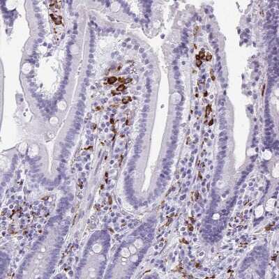 Immunohistochemistry-Paraffin: CD163 Antibody [NBP2-49028]