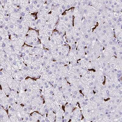 Immunohistochemistry-Paraffin: CD163 Antibody [NBP2-49028]