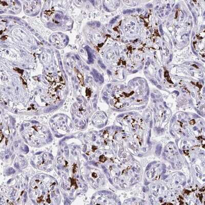 Immunohistochemistry-Paraffin: CD163 Antibody [NBP2-49028]