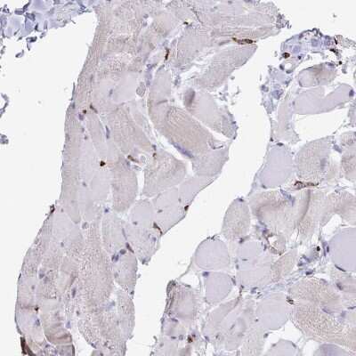 Immunohistochemistry-Paraffin: CD163 Antibody [NBP2-49028]