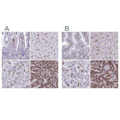 Immunohistochemistry-Paraffin: CD163 Antibody [NBP2-49028]