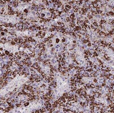Immunohistochemistry-Paraffin: CD163 Antibody [NBP2-49028]