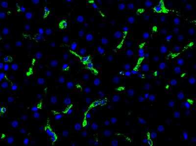 Immunohistochemistry-Paraffin: CD163 Antibody (K20-T) [NBP1-30148]