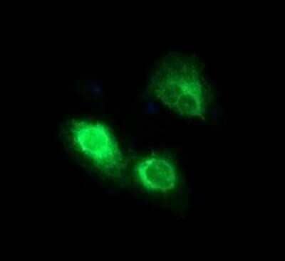 Immunofluorescence: CD163 Antibody (OTI2B12) [NBP2-46115]