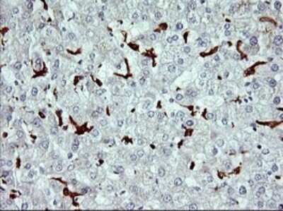 Immunohistochemistry: CD163 Antibody (OTI2B12) [NBP2-46115]