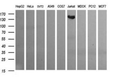 Western Blot: CD163 Antibody (OTI2B12) [NBP2-46115]