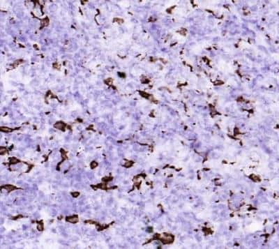 Immunohistochemistry-Frozen: CD163 Antibody (RM3/1) [NBP1-60158]