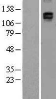 Western Blot: CD163 Overexpression Lysate [NBL1-08909]