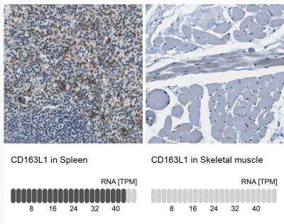 Immunohistochemistry-Paraffin: CD163L1 Antibody [NBP1-86545]