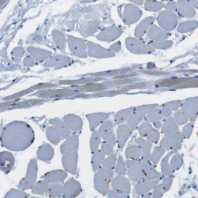 Immunohistochemistry-Paraffin: CD163L1 Antibody [NBP1-86545]