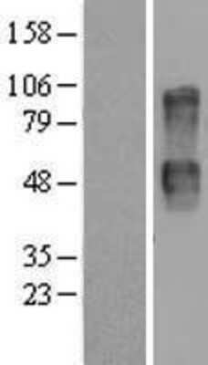 Western Blot: CD164 Overexpression Lysate [NBP2-07671]