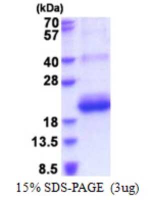 SDS-PAGE: Recombinant Human CD164L2 His Protein [NBP2-51604]