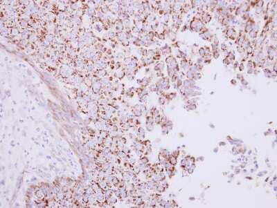 Immunohistochemistry-Paraffin: RHAMM/CD168 Antibody [NBP2-15781]