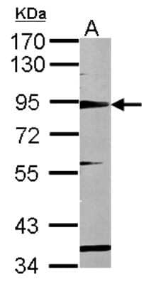 Western Blot: RHAMM/CD168 Antibody [NBP2-15781]