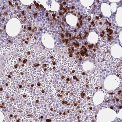 Immunohistochemistry-Paraffin: CD177 Antibody [NBP2-58540]