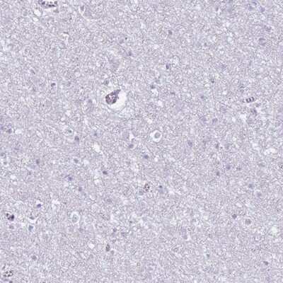 Immunohistochemistry-Paraffin: CD177 Antibody [NBP2-58540]