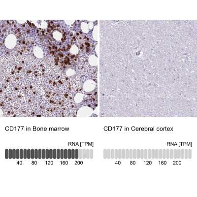 Immunohistochemistry-Paraffin: CD177 Antibody [NBP2-58540]