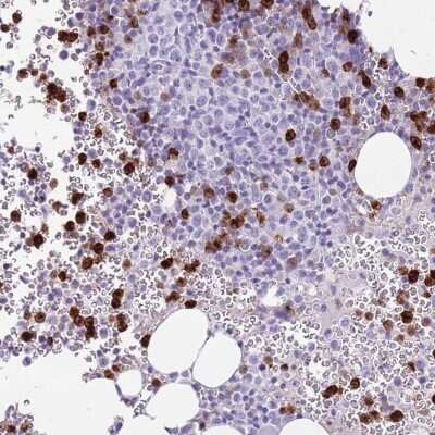 Immunohistochemistry-Paraffin: CD177 Antibody [NBP2-58979]