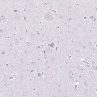 Immunohistochemistry-Paraffin: CD177 Antibody [NBP2-58979]