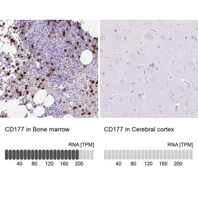 Immunohistochemistry-Paraffin: CD177 Antibody [NBP2-58979]