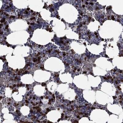 Immunohistochemistry-Paraffin: CD177 Antibody [NBP3-17011]