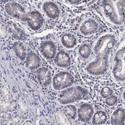 Immunohistochemistry-Paraffin: CD177 Antibody [NBP3-17011]