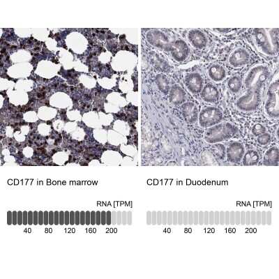 Immunohistochemistry-Paraffin: CD177 Antibody [NBP3-17011]