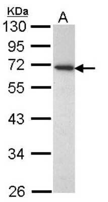 Western Blot: CD177 Antibody [NBP1-31774]