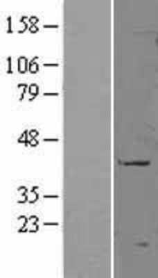 Western Blot: CD177 Overexpression Lysate [NBL1-08911]