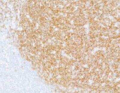 Immunohistochemistry-Paraffin: CD19 Antibody (BLR137H) [NBP3-14717]
