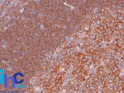 Immunohistochemistry-Paraffin: CD19 Antibody (C19/366) [NBP2-29424]