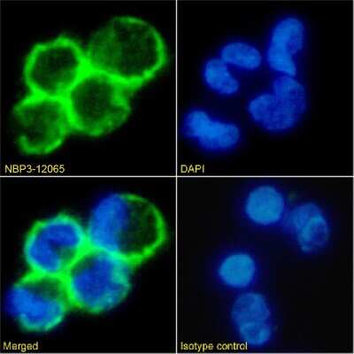 Immunocytochemistry/ Immunofluorescence: CD19 Antibody (CAT-13.1E10) - Chimeric - Azide and BSA Free [NBP3-12065]