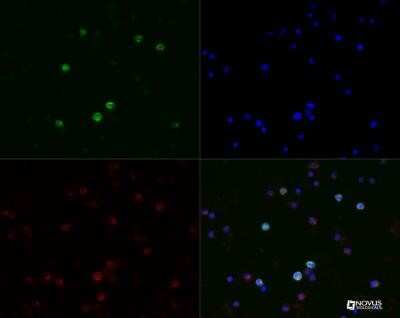 Immunocytochemistry/ Immunofluorescence: CD19 Antibody (CB19) - Azide and BSA Free [NBP2-80634]