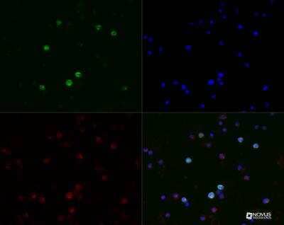 Immunocytochemistry/ Immunofluorescence: CD19 Antibody (CB19) - BSA Free [NBP2-25196]
