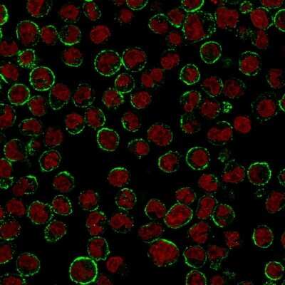 Immunocytochemistry/ Immunofluorescence: CD19 Antibody (CVID3/155) [NBP2-44674]