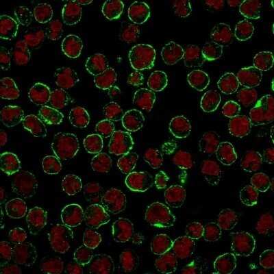 Immunocytochemistry/ Immunofluorescence: CD19 Antibody (CVID3/429) - Azide and BSA Free [NBP2-61909]