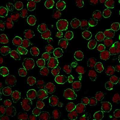 Immunocytochemistry/ Immunofluorescence: CD19 Antibody (CVID3/429) [NBP2-44675]