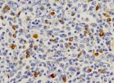 Immunohistochemical Staining of CD19 in Paraffin Embedded Human Spleen