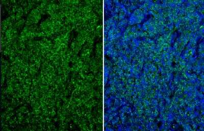 Immunohistochemistry-Paraffin: CD19 Antibody [NBP2-15782]