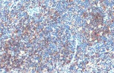 Immunohistochemistry-Paraffin: CD19 Antibody [NBP2-15782]