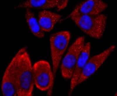 Immunocytochemistry/ Immunofluorescence: CD19 Antibody (JF100-06) [NBP2-67229]