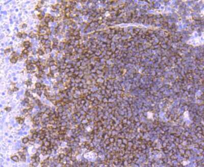 Immunohistochemistry-Paraffin: CD19 Antibody (JF100-06) [NBP2-67229]