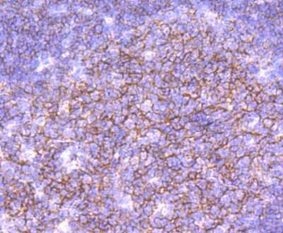 Immunohistochemistry-Paraffin: CD19 Antibody (JF100-06) [NBP2-67229]