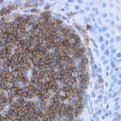 Immunohistochemistry: CD19 Antibody (LE-CD19) - BSA Free [NB100-65672]