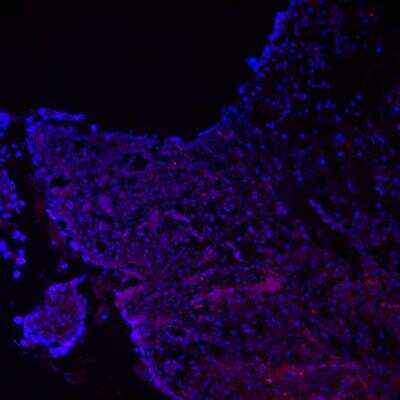 Immunohistochemistry-Frozen: CD19 Antibody (SJ25-C1) [NBP1-28375]