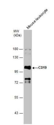 Western Blot: CD19 Antibody [NBP2-15782]