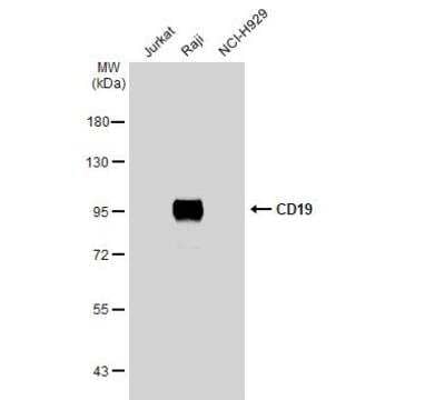 Western Blot: CD19 Antibody [NBP2-15782]